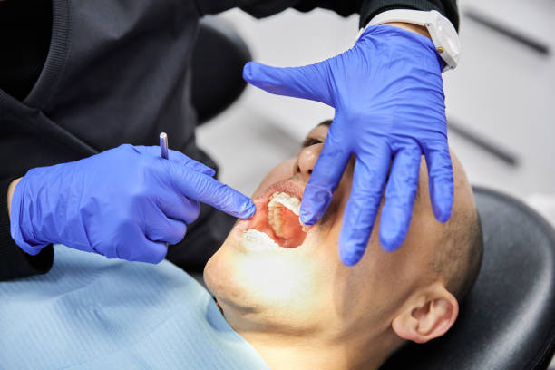 Best Emergency Wisdom Teeth Removal in Barton, NM