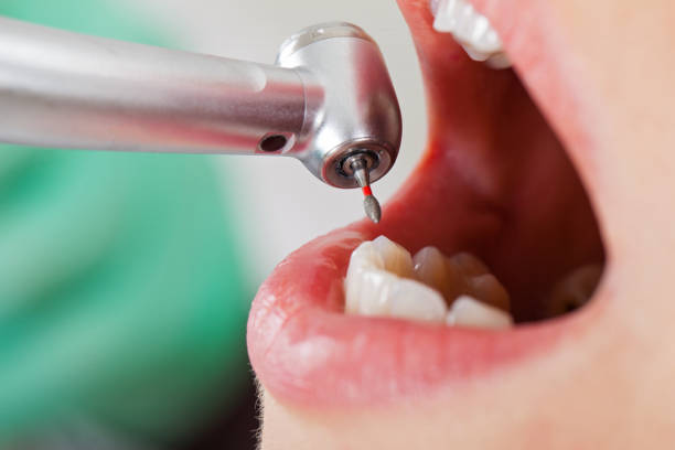 Best Emergency Dental Surgery in Barton, NM